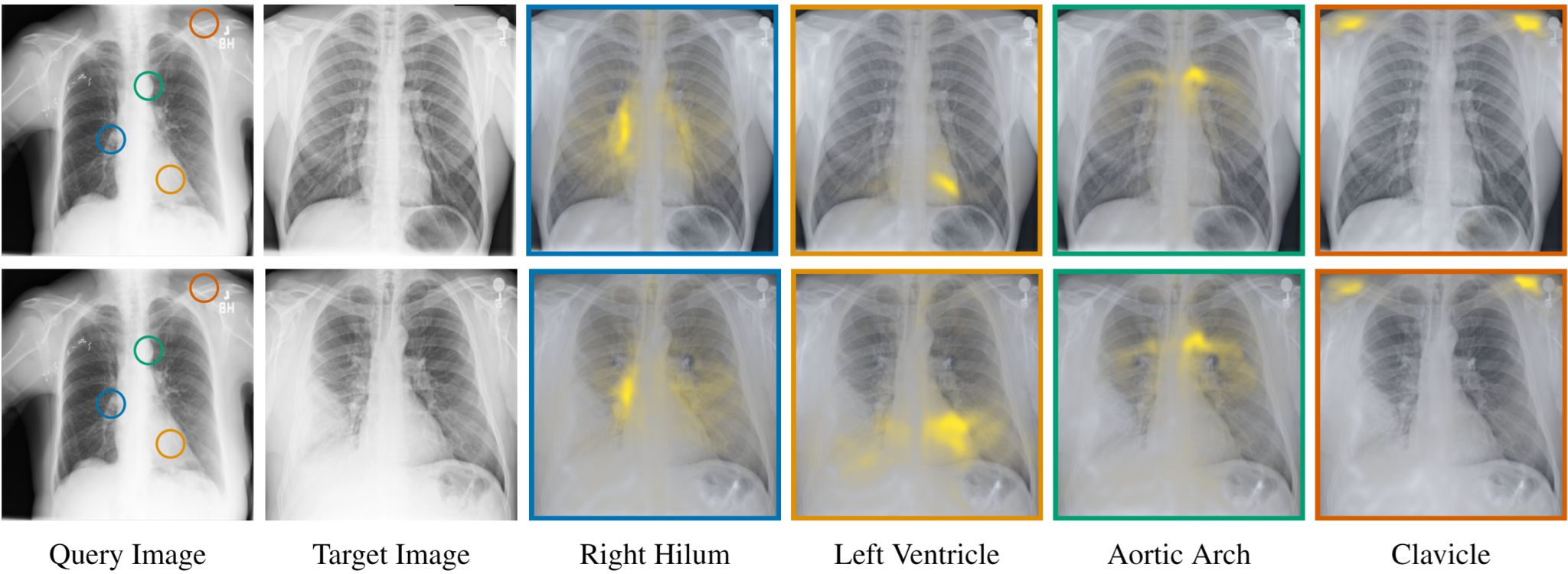 The technology identifies anatomical matches between chest X-rays of different subjects.