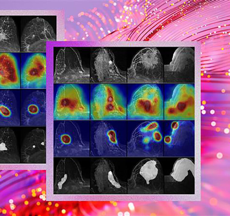 Radiology results.